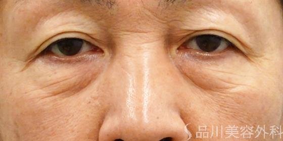 症例NO.49748のBEFORE写真