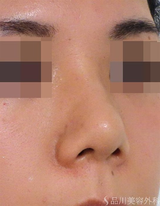 症例NO.39898のBEFORE写真