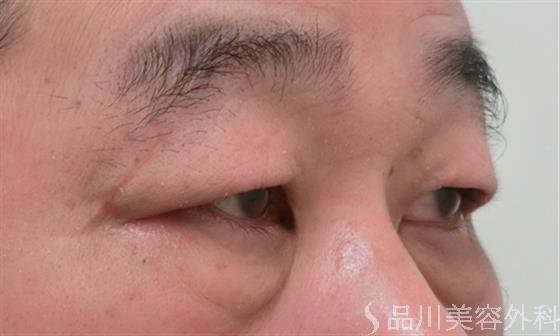症例NO.26428のBEFORE写真