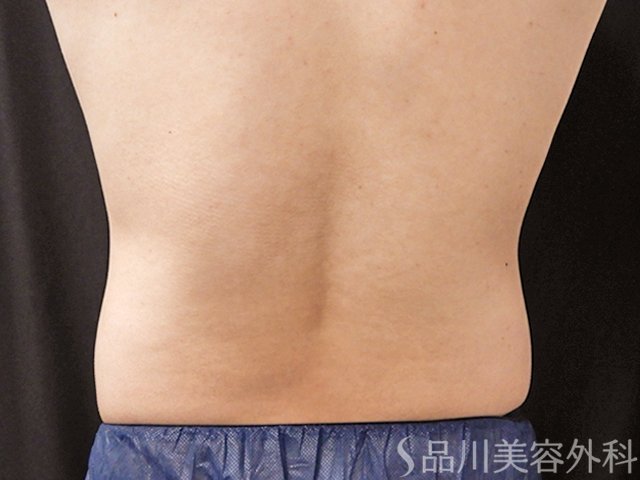 症例NO.73749のBEFORE写真