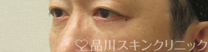 症例NO.74836のAFTER写真