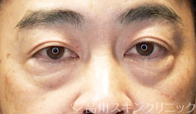 症例NO.65423のBEFORE写真