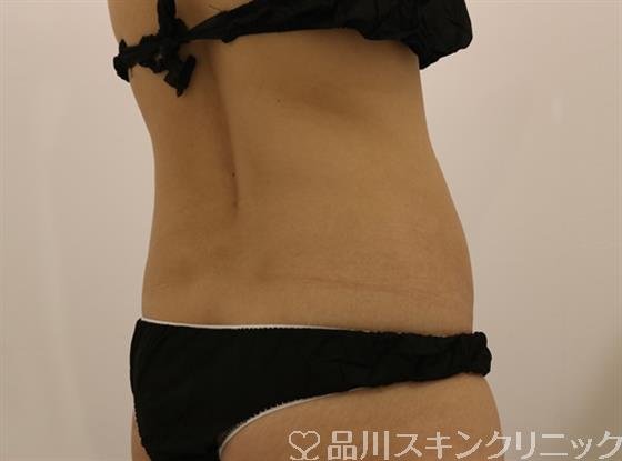症例NO.43724のBEFORE写真