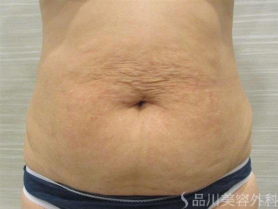 症例NO.20737のAFTER写真