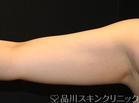 症例NO.70099のBEFORE写真