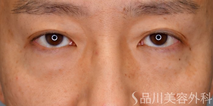 症例NO.73101のBEFORE写真