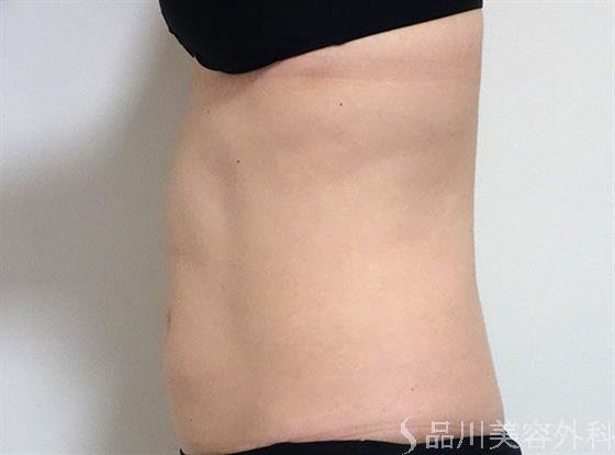症例NO.25234のBEFORE写真