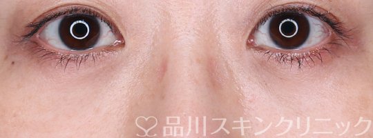 症例NO.73664のAFTER写真