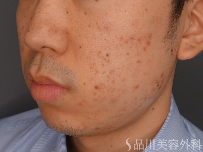 症例NO.73672のAFTER写真