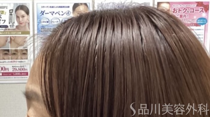 症例NO.68290のBEFORE写真