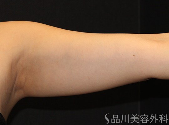 症例NO.73029のBEFORE写真