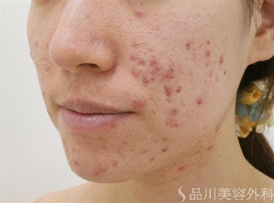 症例NO.26638のBEFORE写真