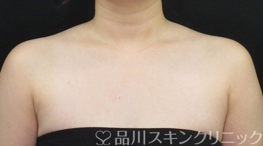 症例NO.70123のBEFORE写真