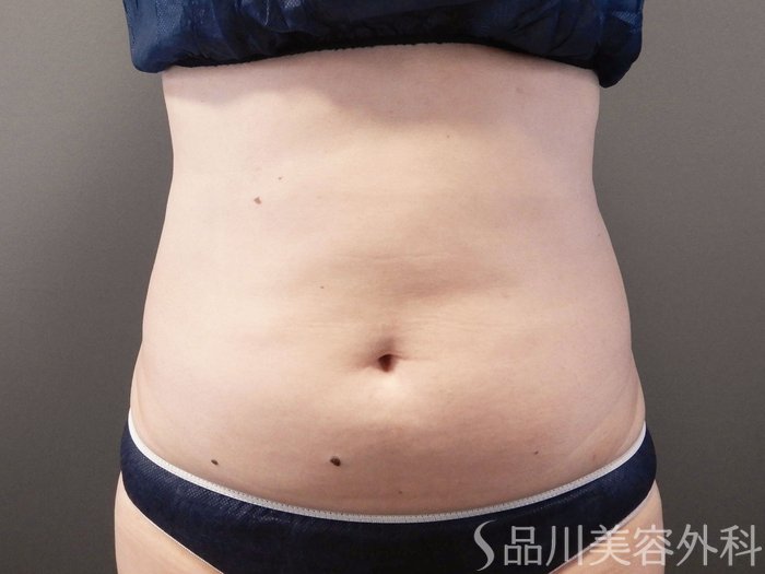 症例NO.65691のBEFORE写真