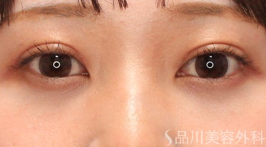 症例NO.70291のAFTER写真