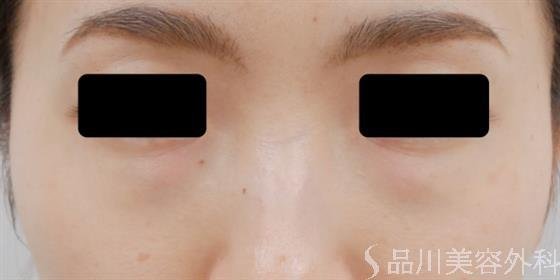 症例NO.35505のBEFORE写真