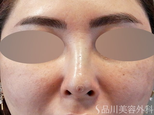 症例NO.67609のAFTER写真