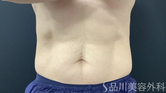 症例NO.75386のAFTER写真
