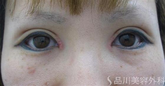 症例NO.10002のAFTER写真
