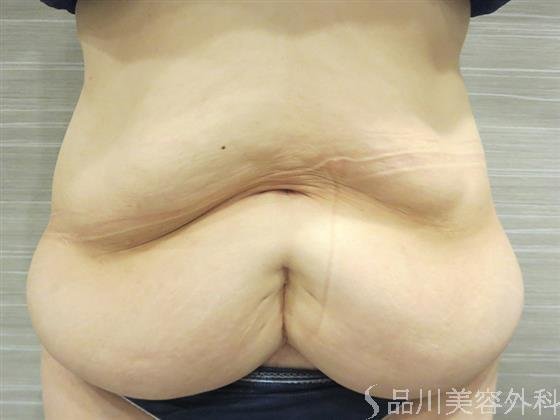 症例NO.20564のBEFORE写真