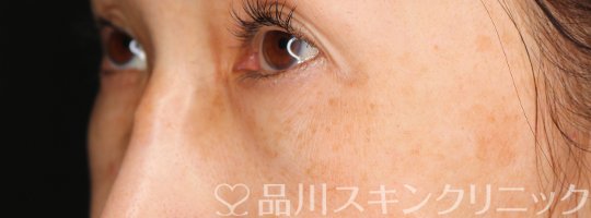 症例NO.69831のBEFORE写真