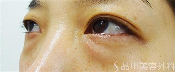 症例NO.25302のBEFORE写真