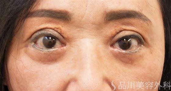 症例NO.53526のAFTER写真