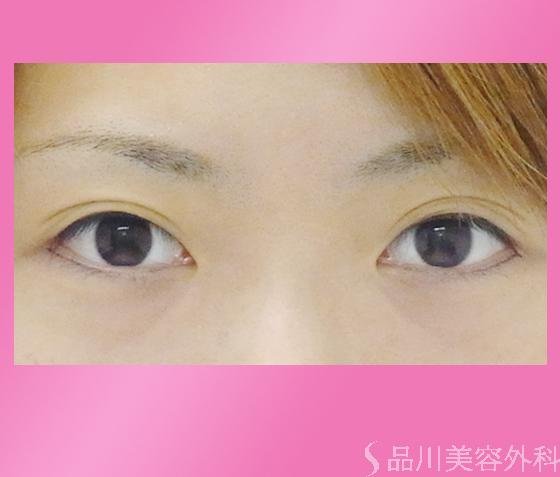 症例NO.673のBEFORE写真