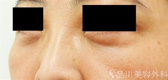 症例NO.39676のAFTER写真
