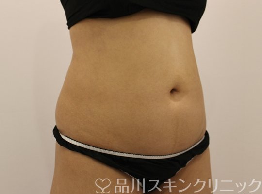 症例NO.73653のBEFORE写真