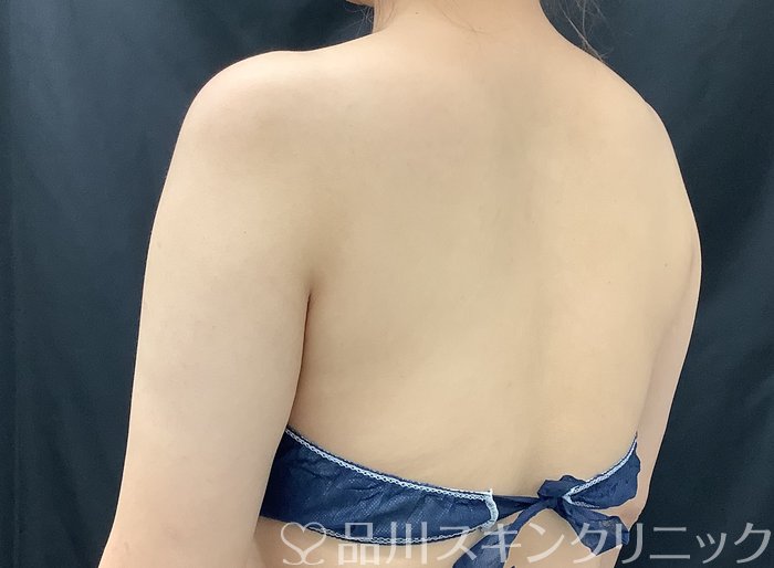症例NO.67993のAFTER写真
