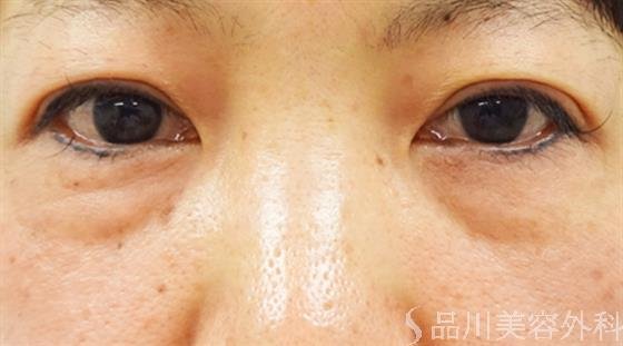 症例NO.31952のBEFORE写真