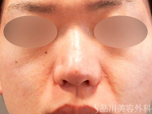 症例NO.70282のAFTER写真