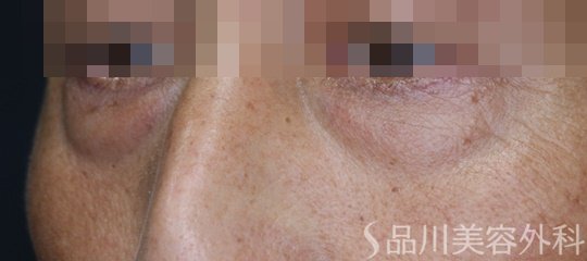 症例NO.63919のBEFORE写真