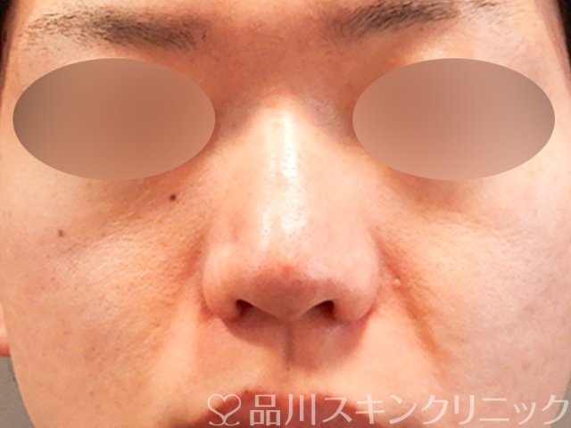 症例NO.70282のAFTER写真