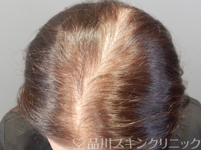 症例NO.68636のBEFORE写真