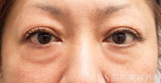 症例NO.53009のBEFORE写真