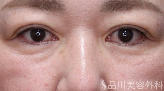 症例NO.67541のAFTER写真