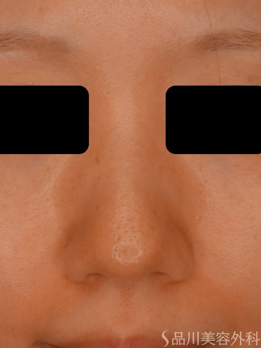 症例NO.73759のBEFORE写真