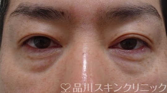 症例NO.70784のBEFORE写真