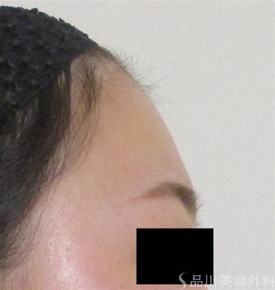 症例NO.59193のBEFORE写真