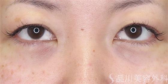 症例NO.48299のAFTER写真