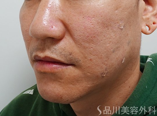 症例NO.73521のAFTER写真