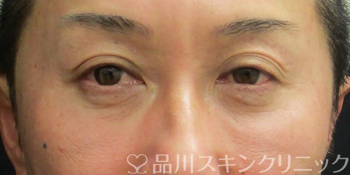 症例NO.73198のBEFORE写真
