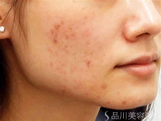 症例NO.57547のAFTER写真