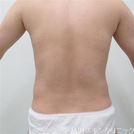 症例NO.27605のBEFORE写真