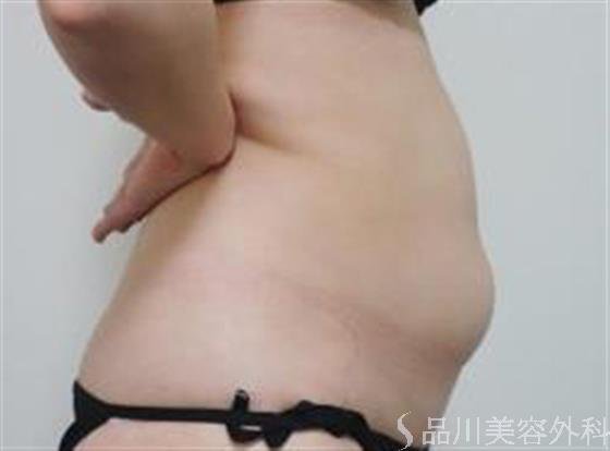 症例NO.23178のBEFORE写真