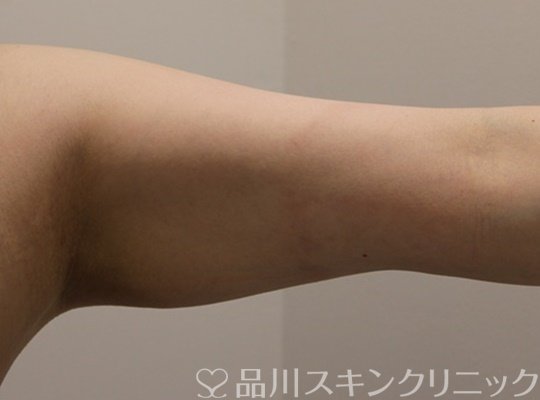 症例NO.72099のBEFORE写真