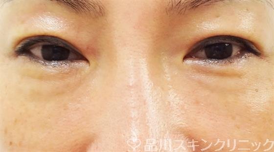 症例NO.31188のBEFORE写真