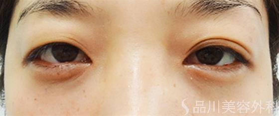 症例NO.25302のAFTER写真